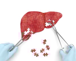 Hepatits A